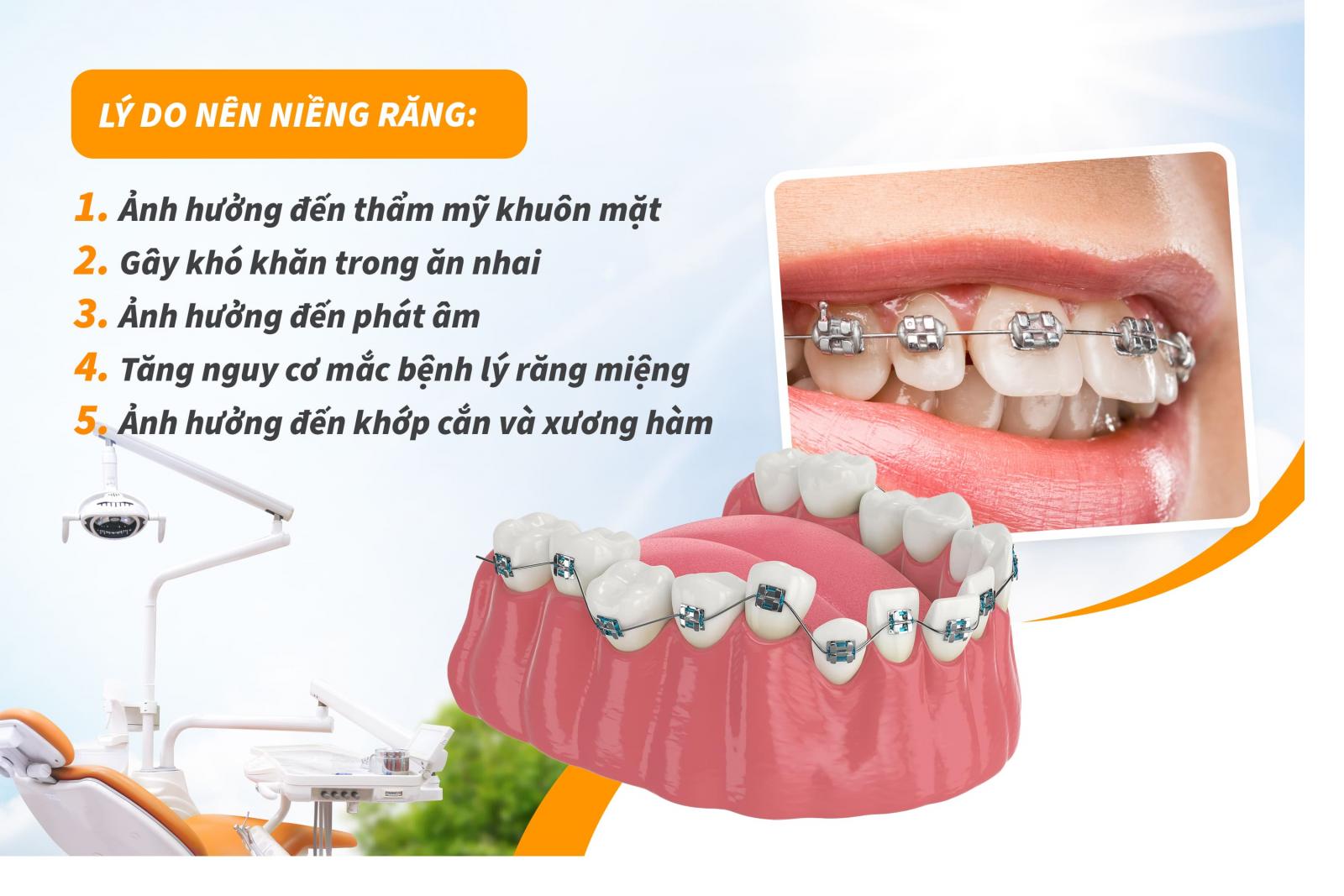 Lý do nên niềng răng?