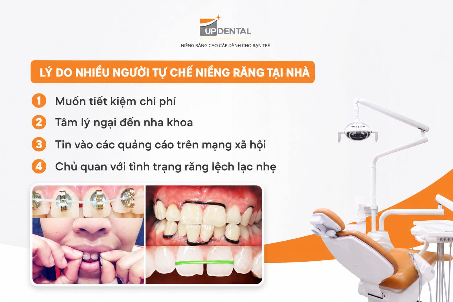 Lý do nhiều người chọn tự chế niềng răng tại nhà