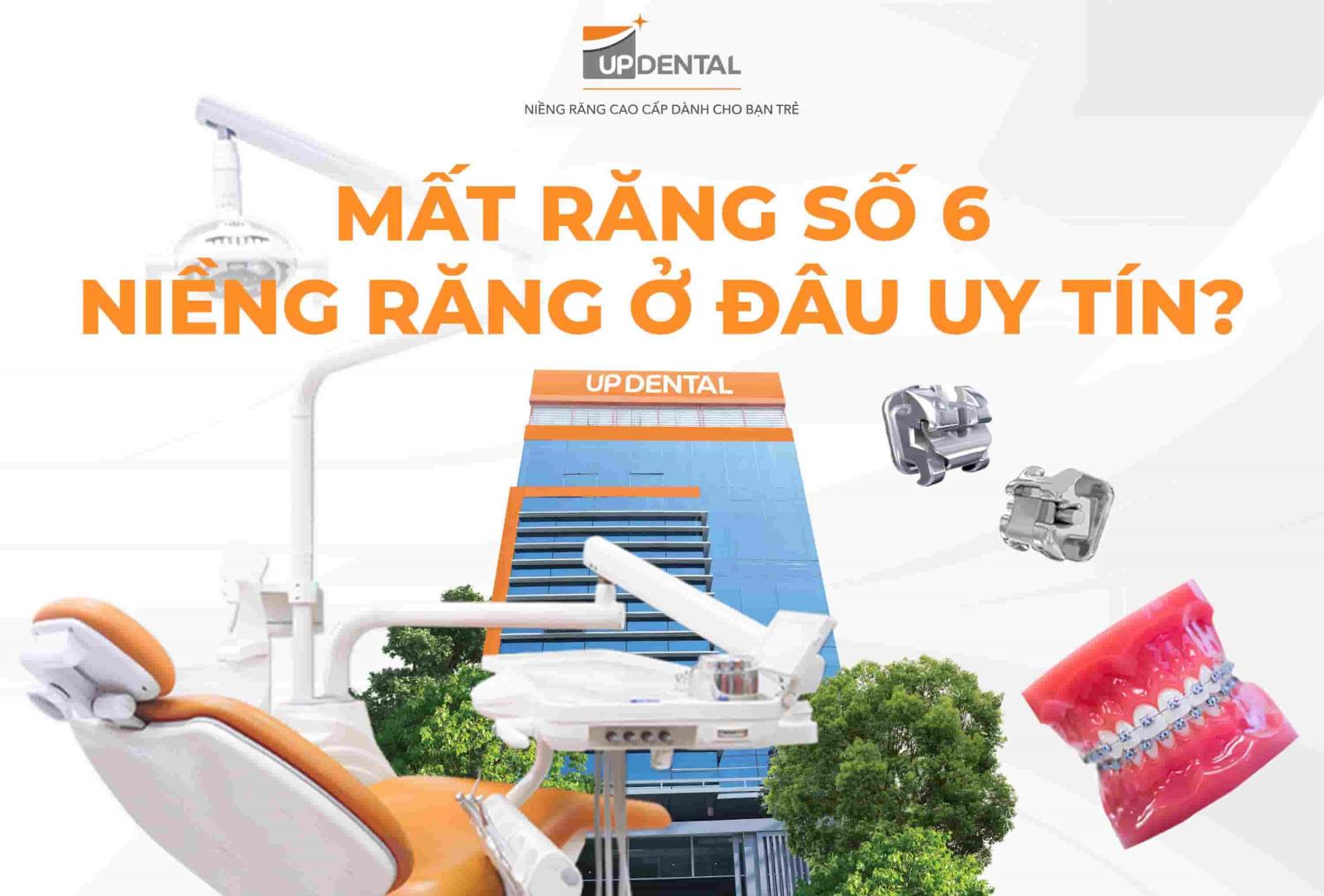 Mất răng số 6 niềng răng ở đâu uy tín?