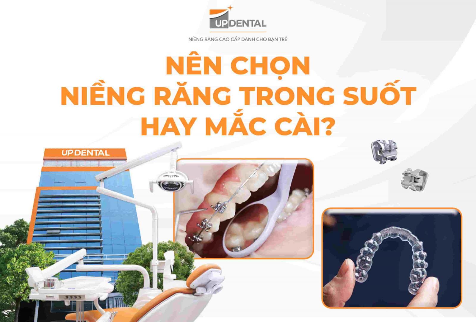 Nên niềng răng trong suốt hay mắc cài?
