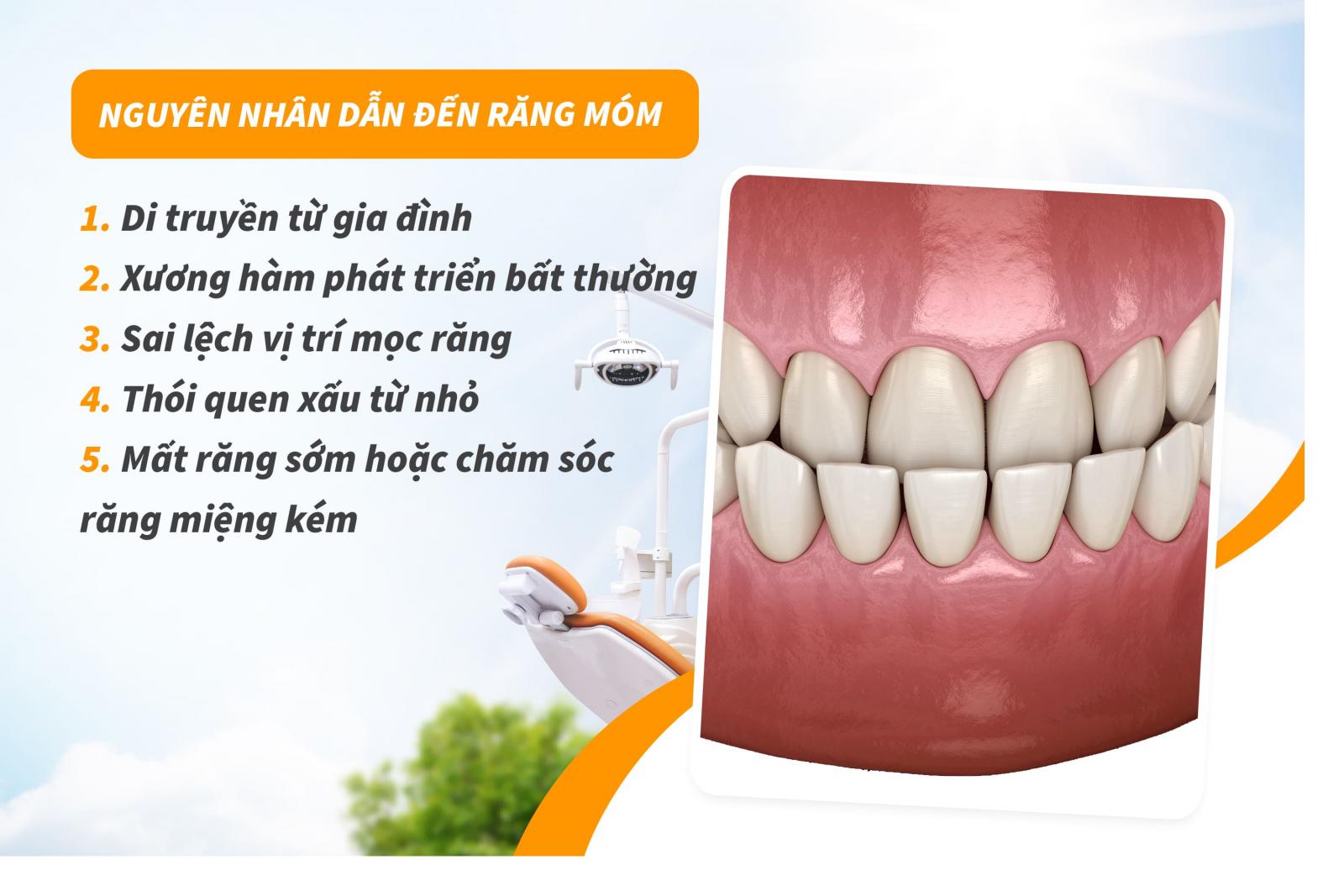 Nguyên nhân dẫn đến răng móm