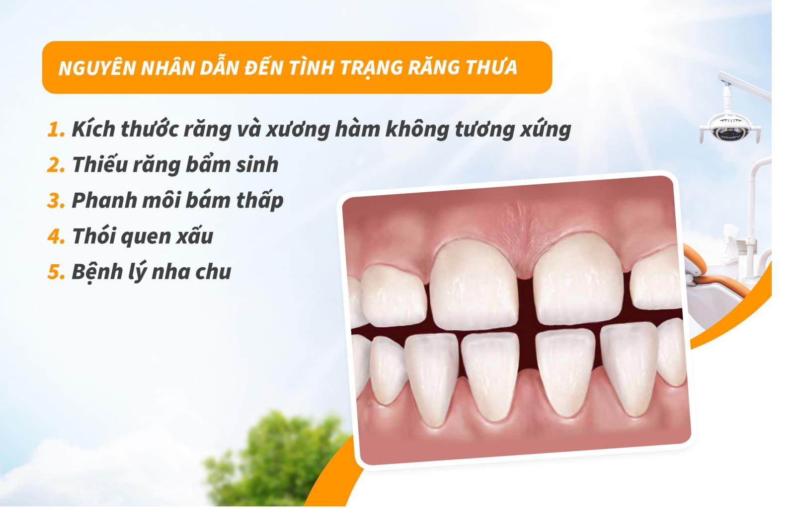 Nguyên nhân dẫn đến tình trạng răng thưa