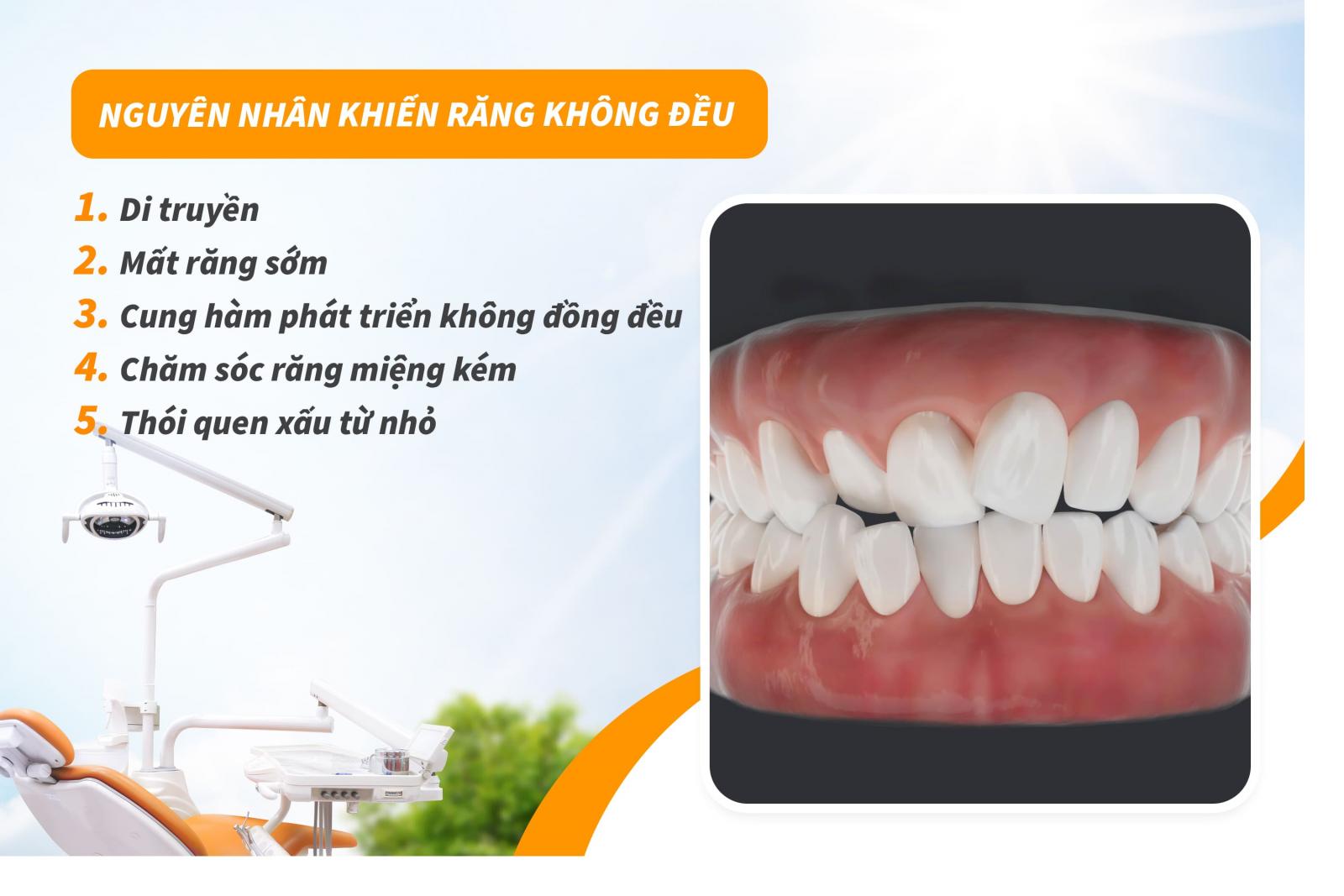 Nguyên nhân khiến răng không đều