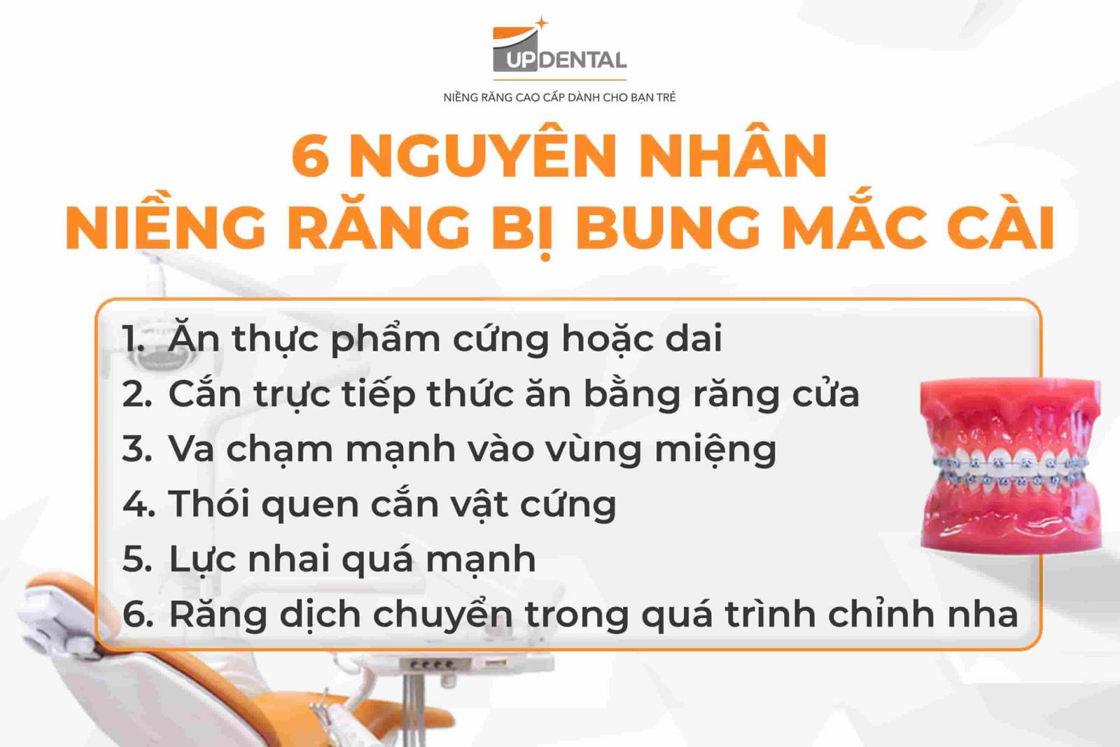6 nguyên nhân niềng răng bị bung mắc cài