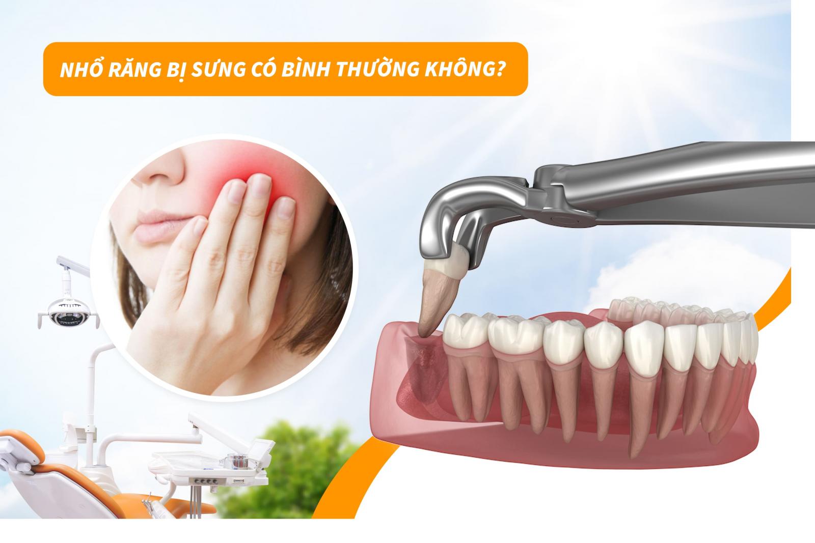 Nhổ răng bị sưng có bình thường không?