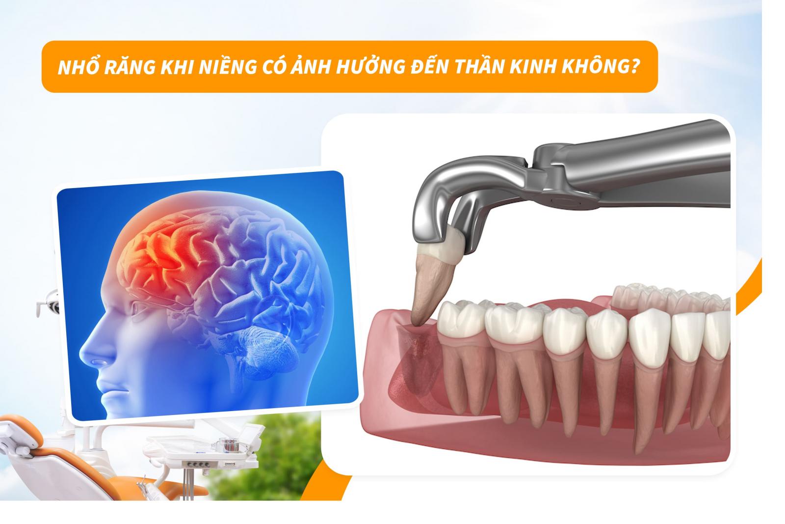 Nhổ răng khi niềng có ảnh hưởng đến thần kinh không?