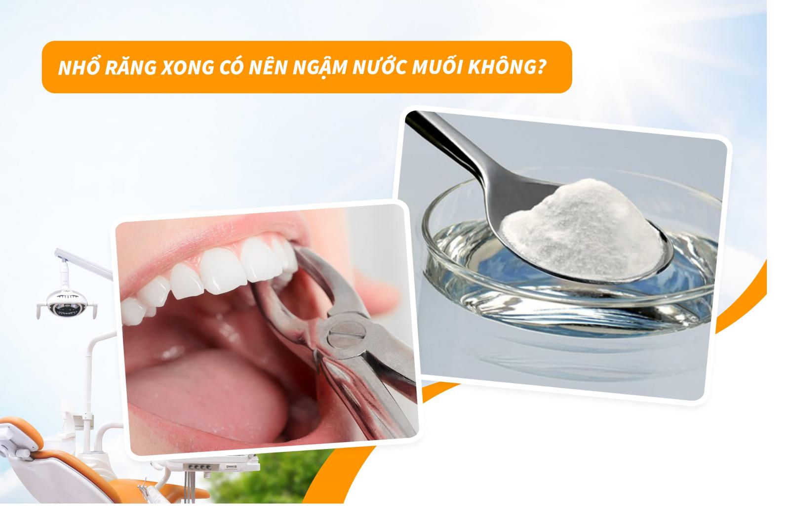 Nhổ răng xong có nên ngậm nước muối không?