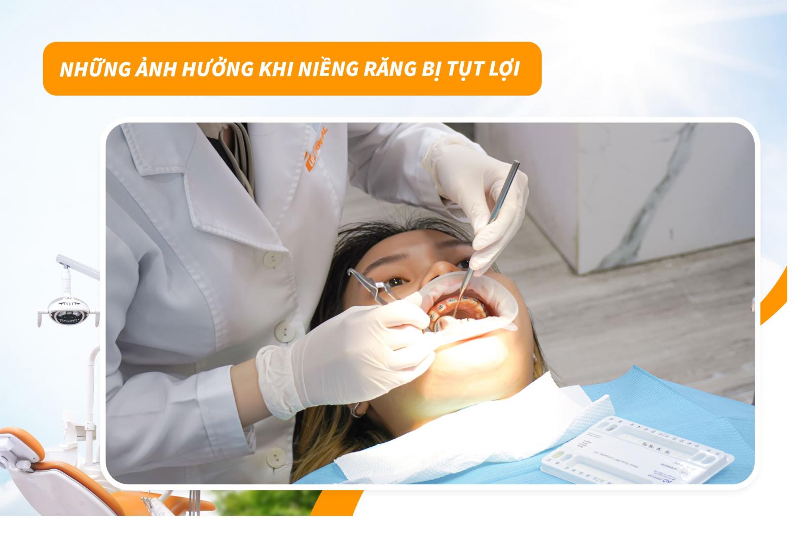 Những ảnh hưởng khi niềng răng bị tụt lợi