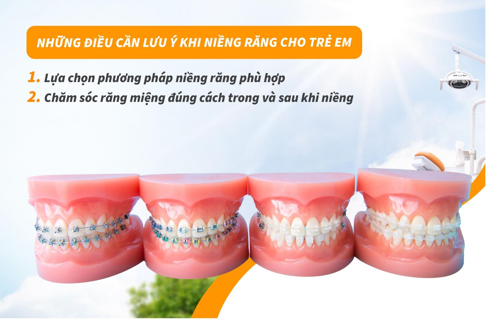 Những điều cần lưu ý khi niềng răng cho trẻ em