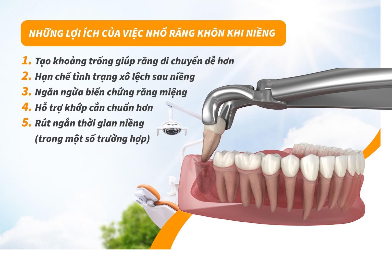 Những lợi ích của việc nhổ răng khôn khi niềng