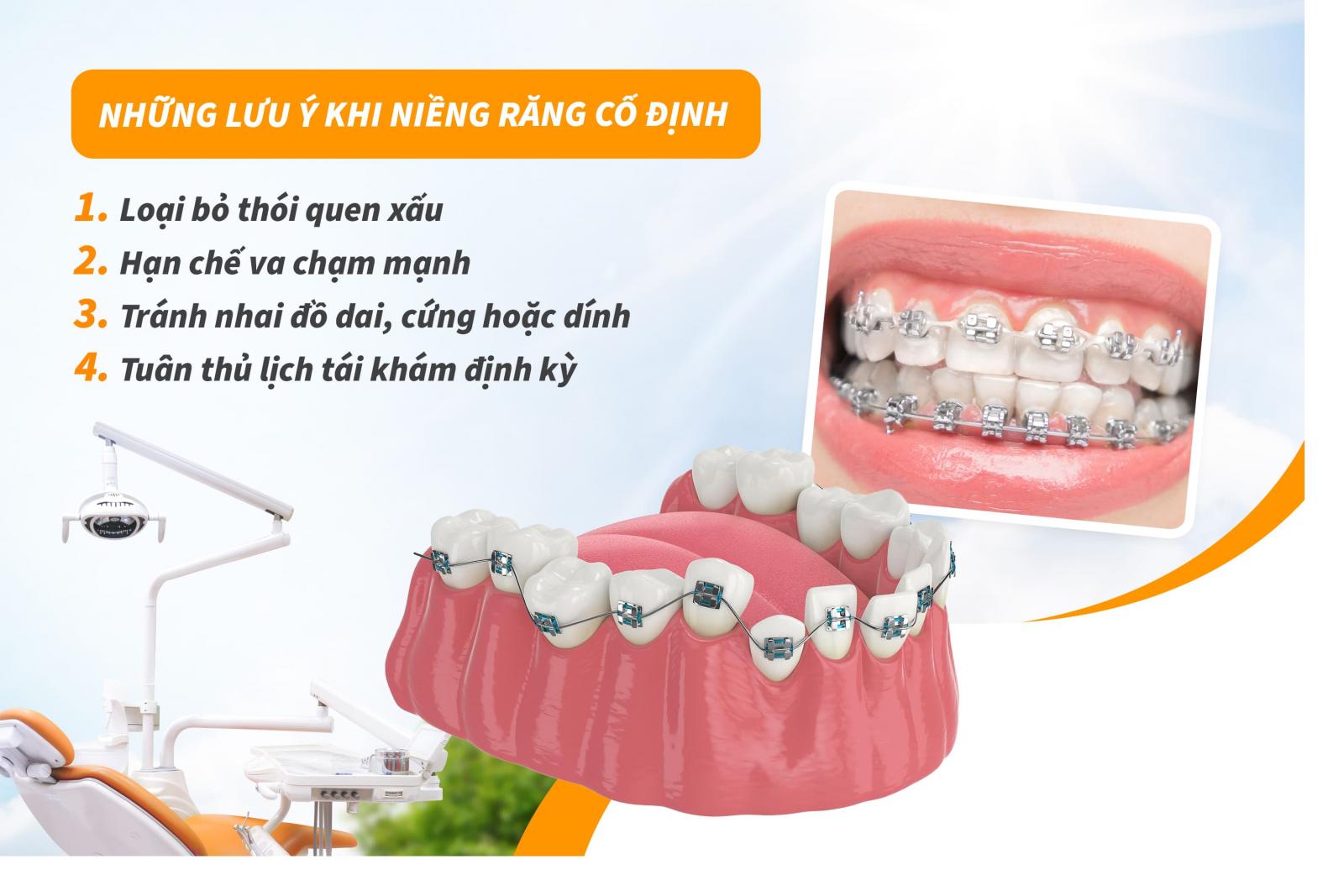 Những lưu ý khi niềng răng cố định