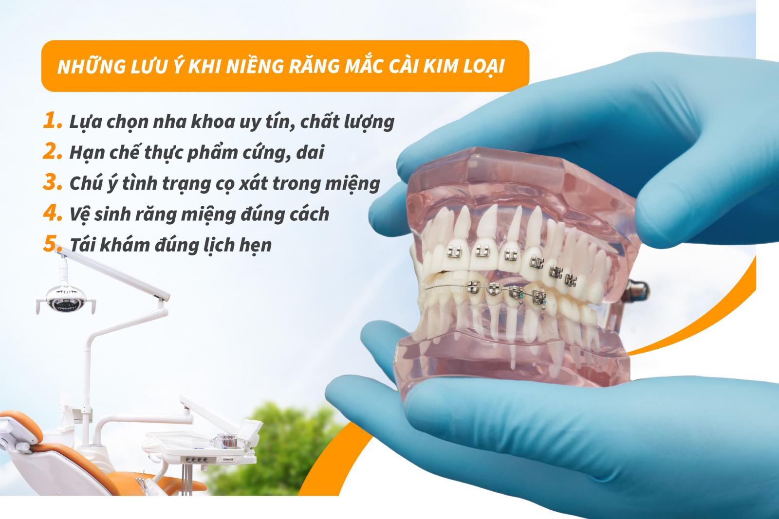 Những lưu ý khi niềng răng mắc cài kim loại