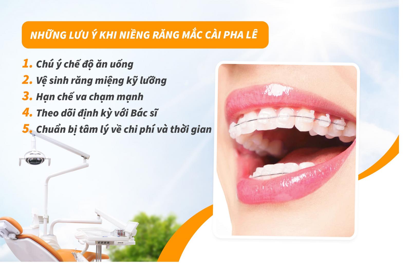 Những lưu ý khi niềng răng mắc cài pha lê