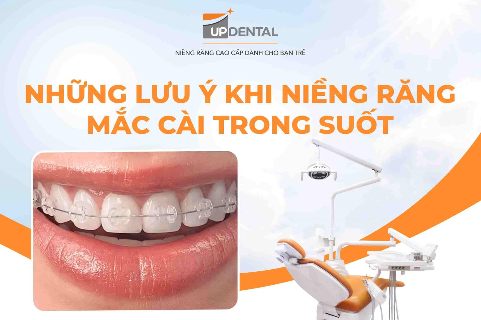 Những lưu ý khi niềng răng mắc cài trong suốt