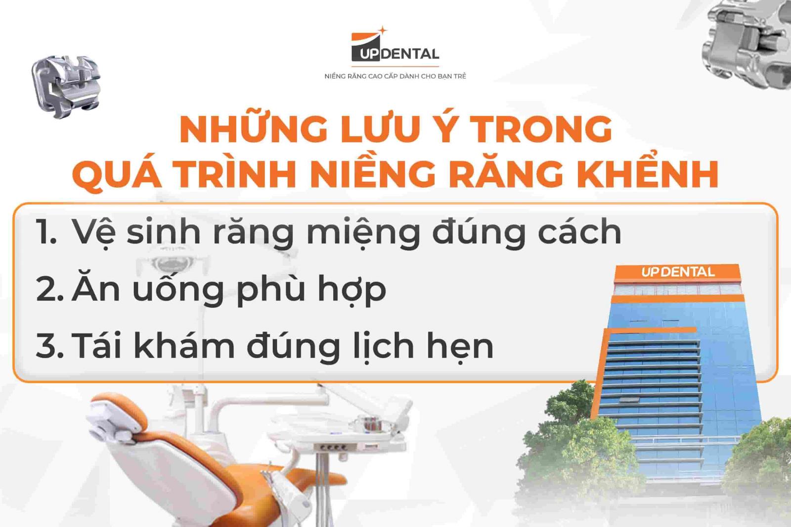 Những lưu ý trong quá trình niềng răng khểnh