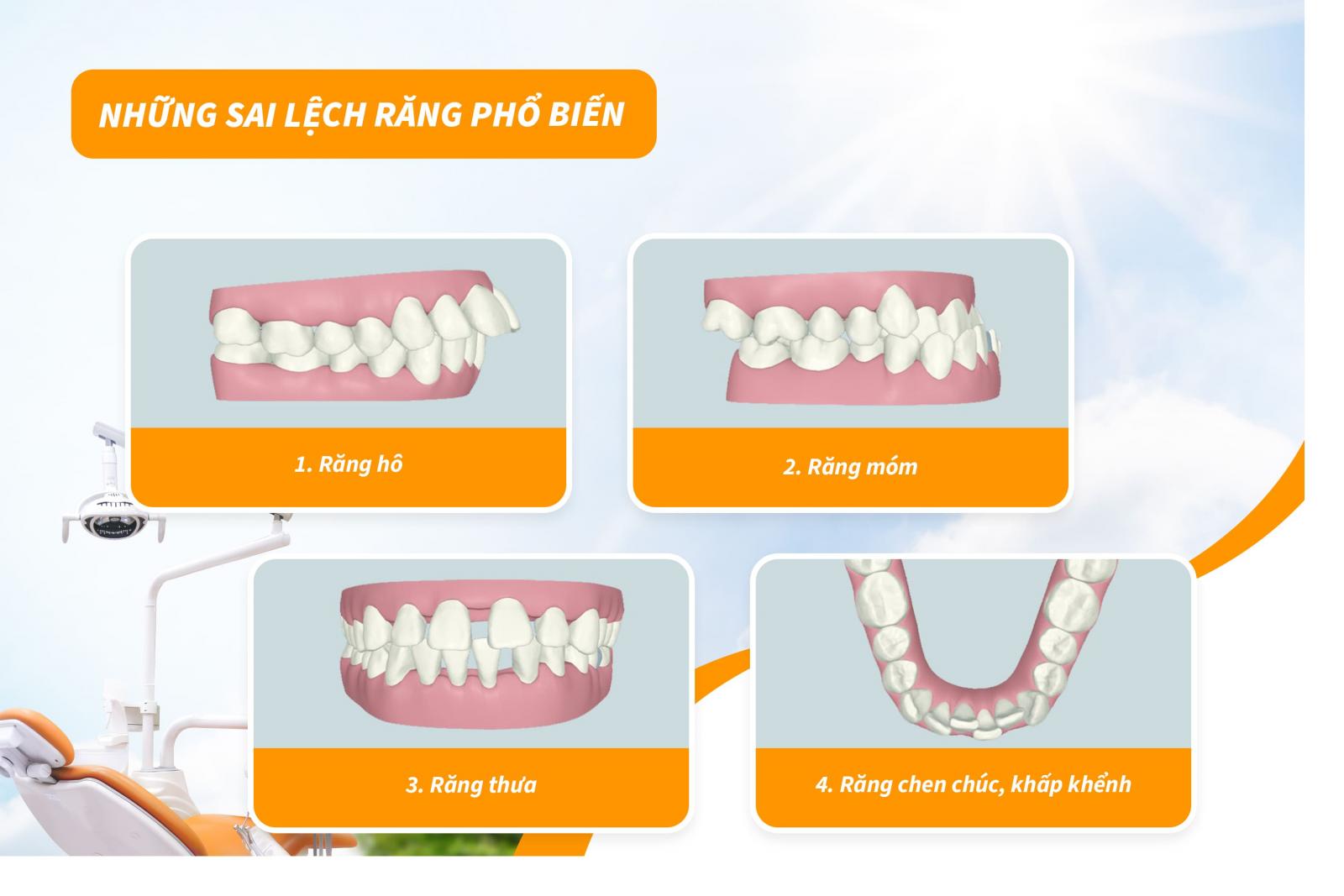 Những sai lệch răng phổ biến