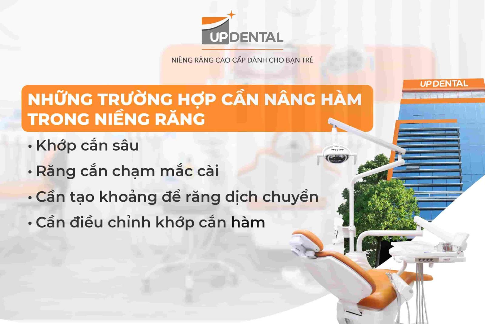 Những trường hợp cần nâng hàm trong niềng răng