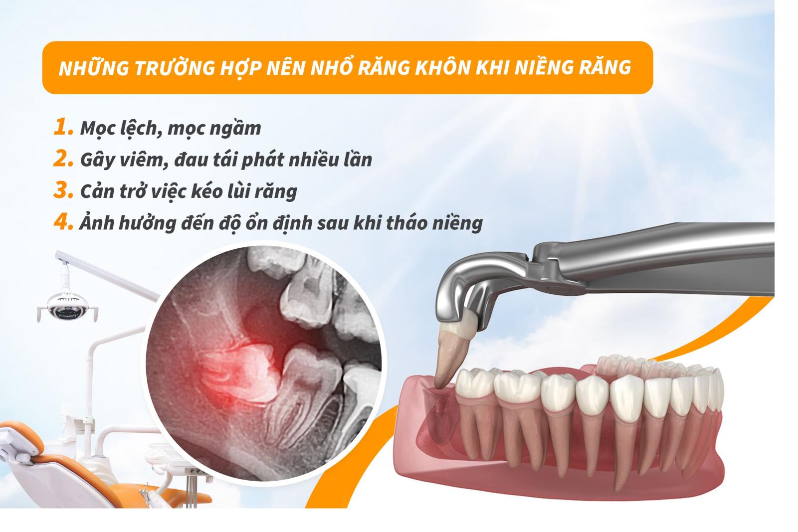 Khi nào cần nhổ răng khôn trước hoặc trong khi niềng răng?