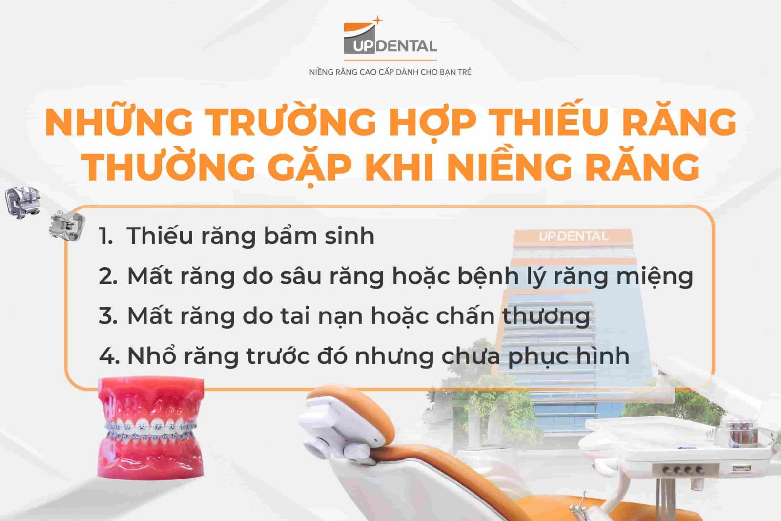 Những trường hợp thiếu răng thường gặp khi niềng răng