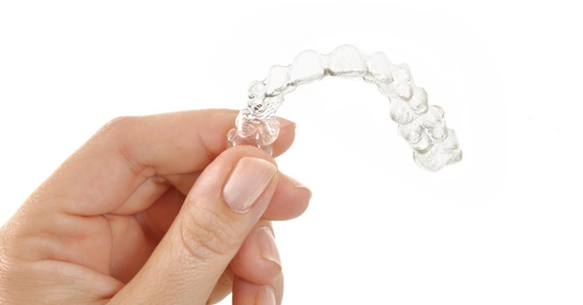 nieng-rang-khong-mac-cai-invisalign