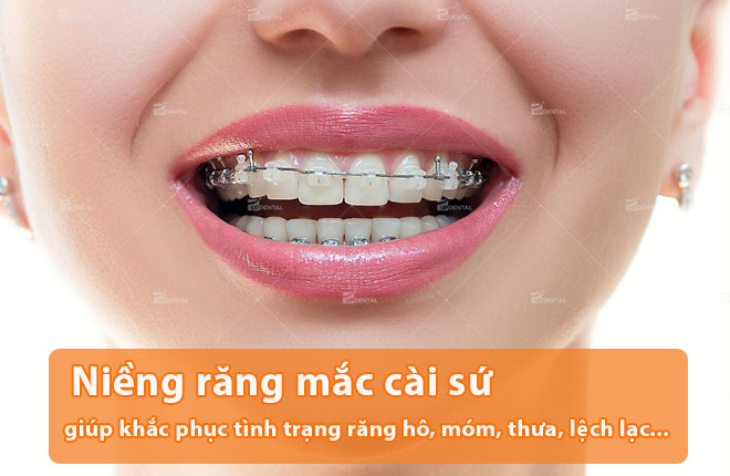 nieng-rang-mac-cai-su-tu-dong