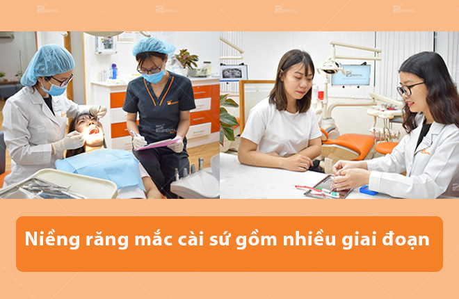 quy trinh nieng rang mac cai su