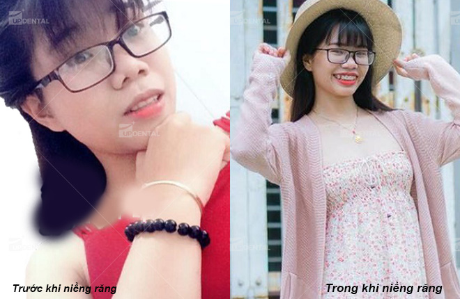 nieng rang tri ho