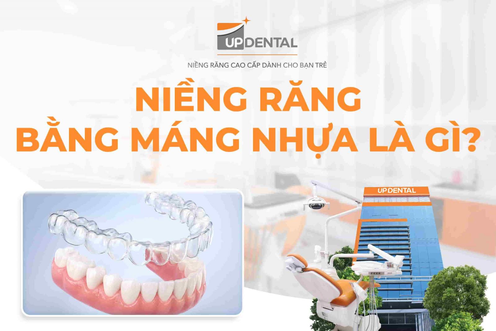 Niềng răng bằng máng nhựa là gì?