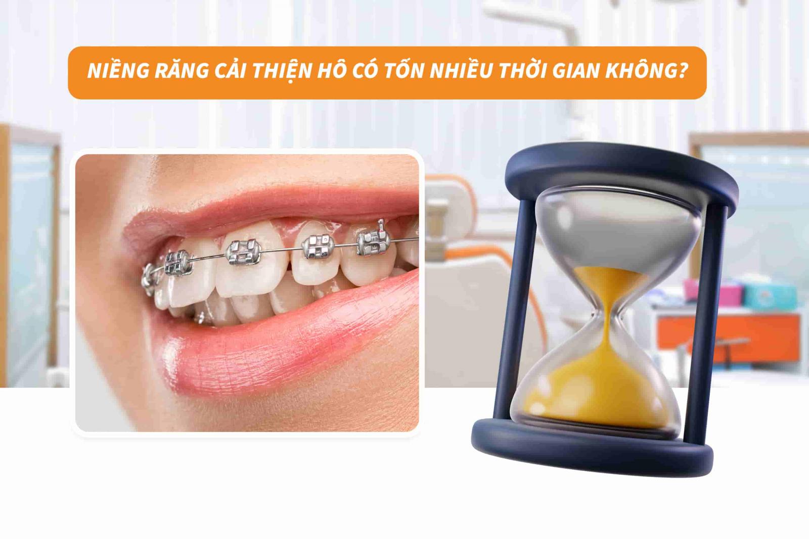Niềng răng cải thiện hô có tốn thời gian không?