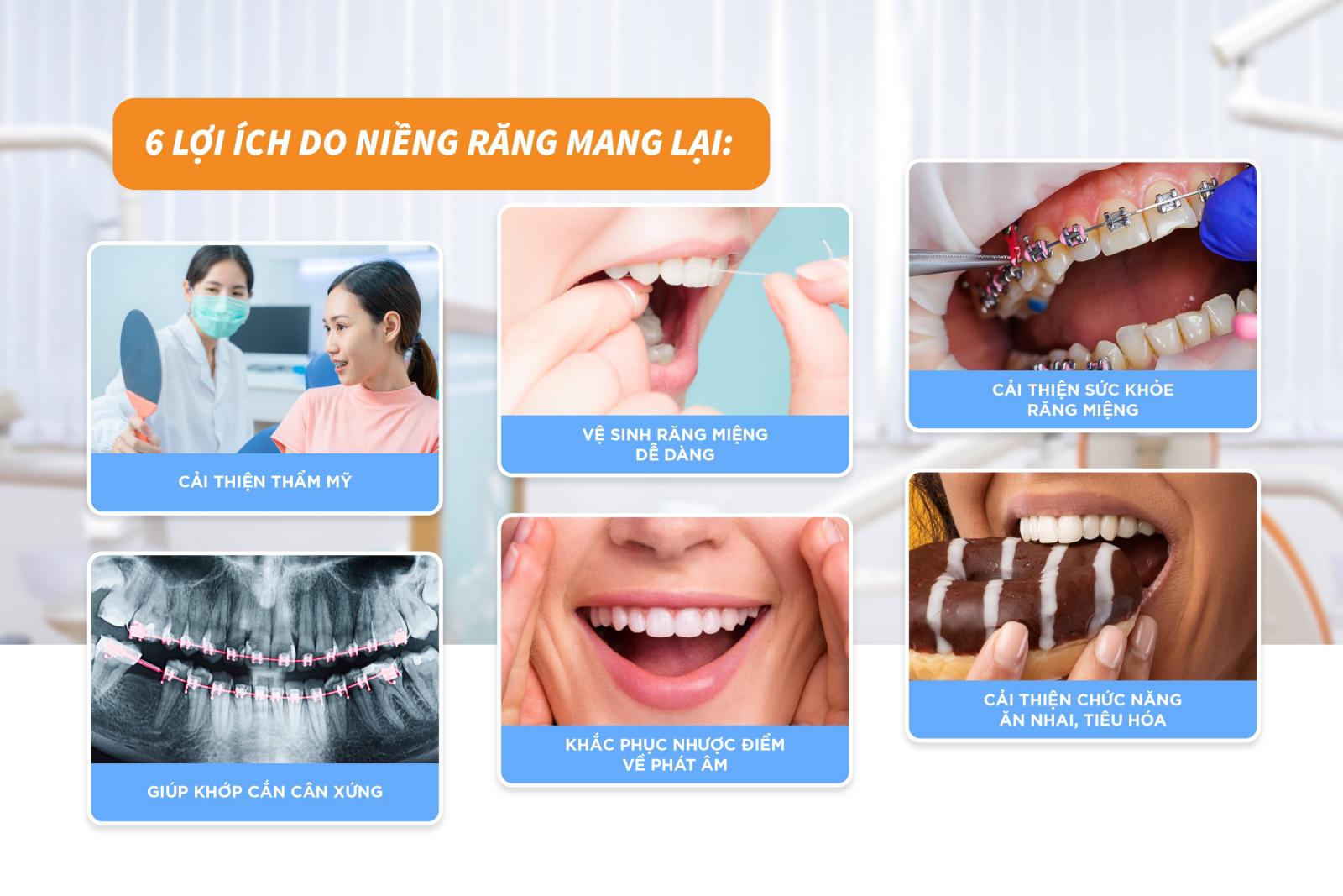 Niềng răng cho người lớn được không? 6 lợi ích do niềng răng mang lại