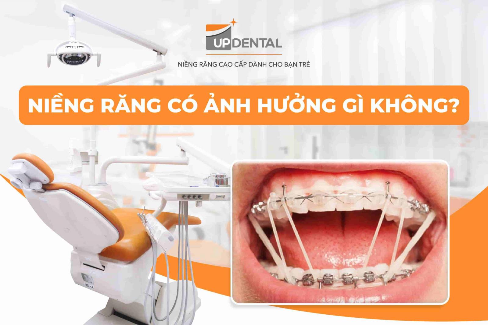 Niềng răng có ảnh hưởng gì không?