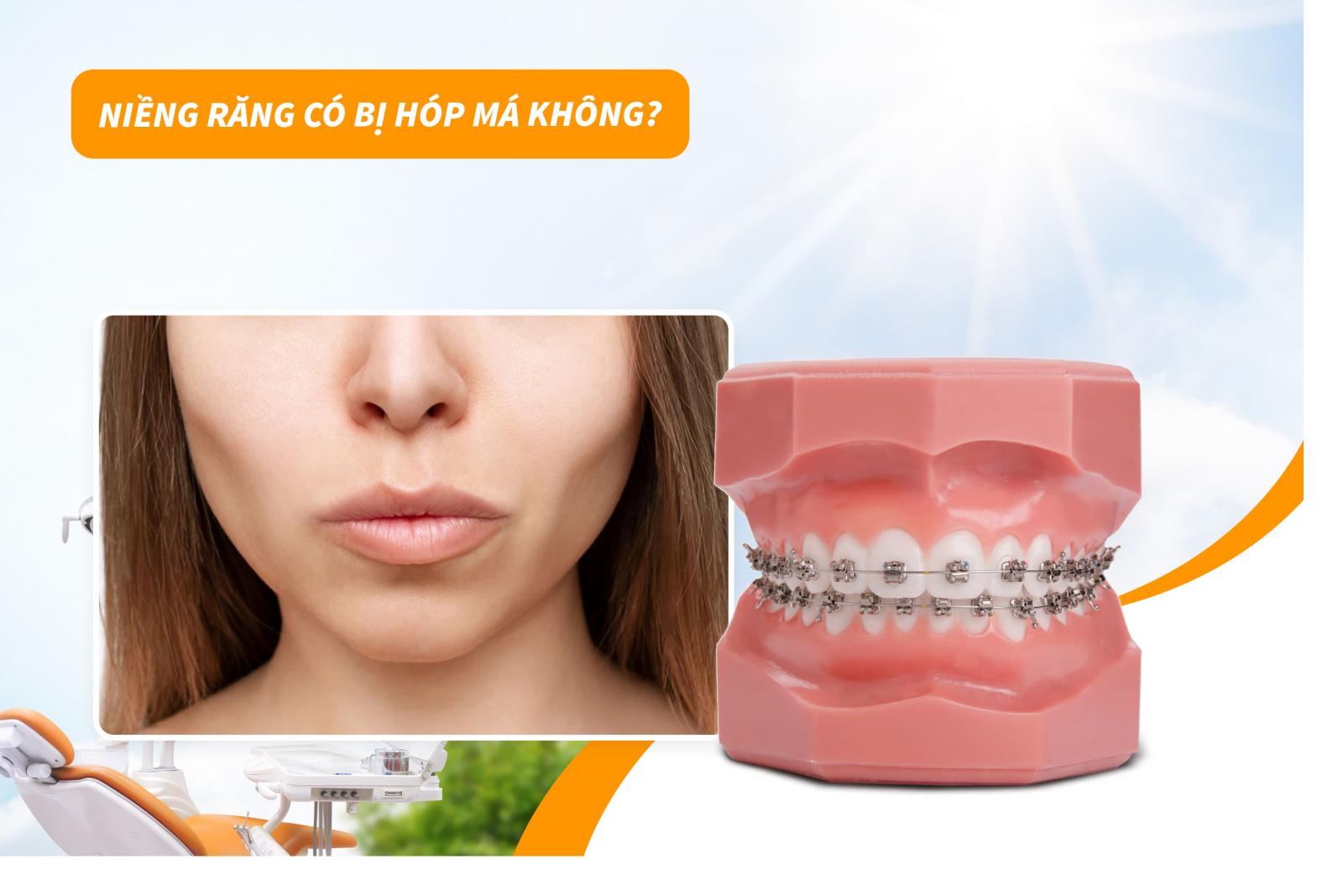Niềng răng có bị hóp má không?