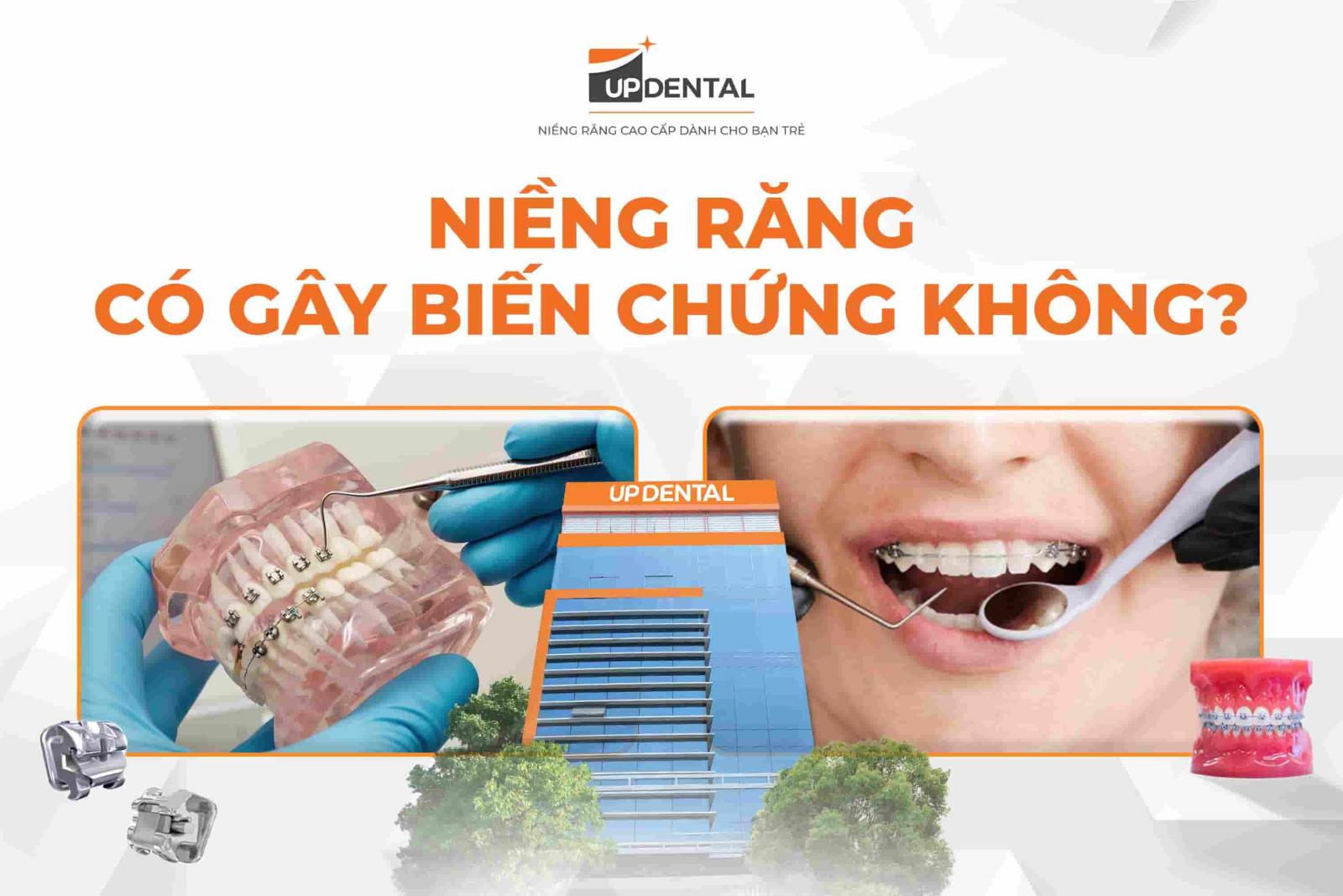 Niềng răng có gây biến chứng không?