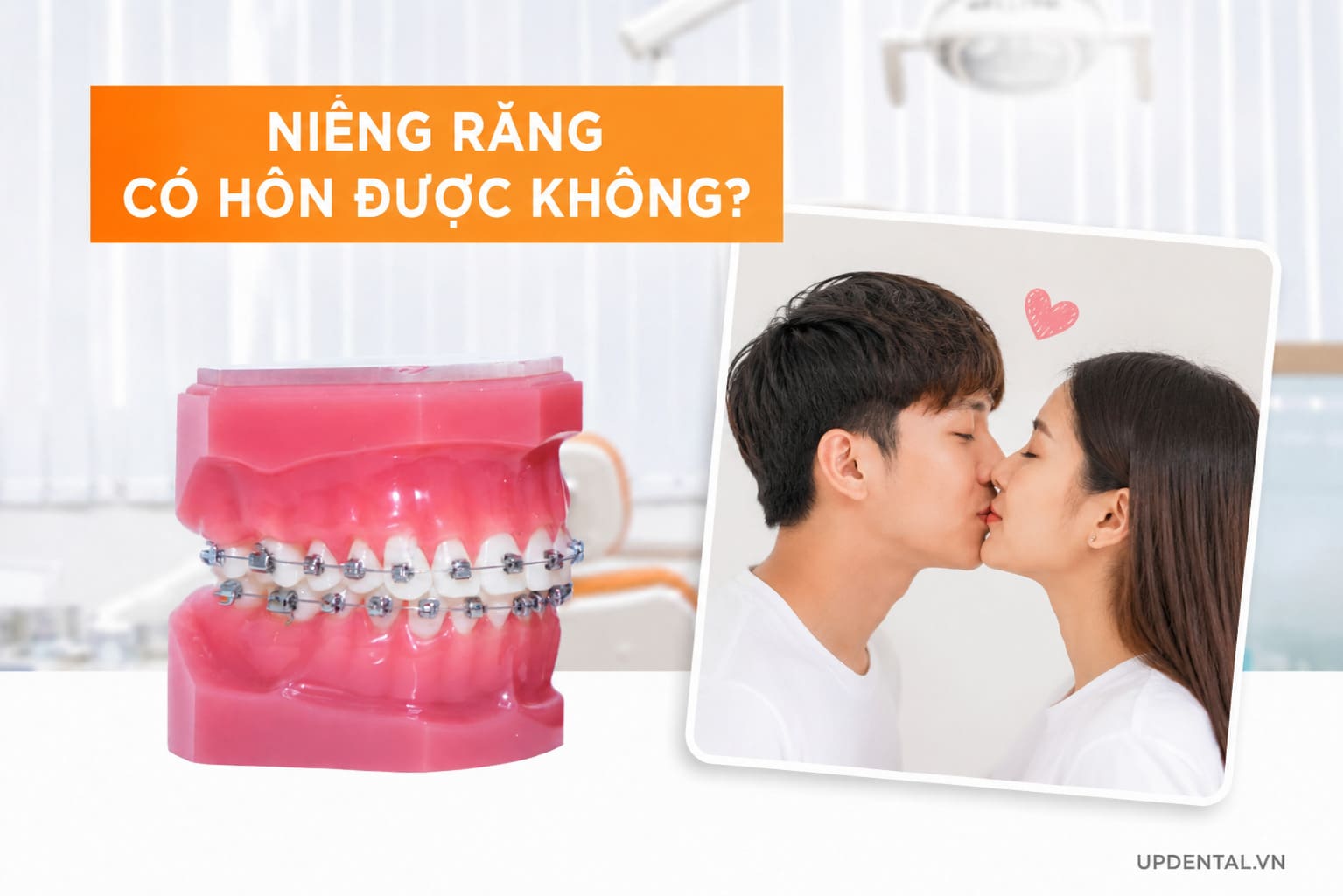 Niềng răng có hôn được không?