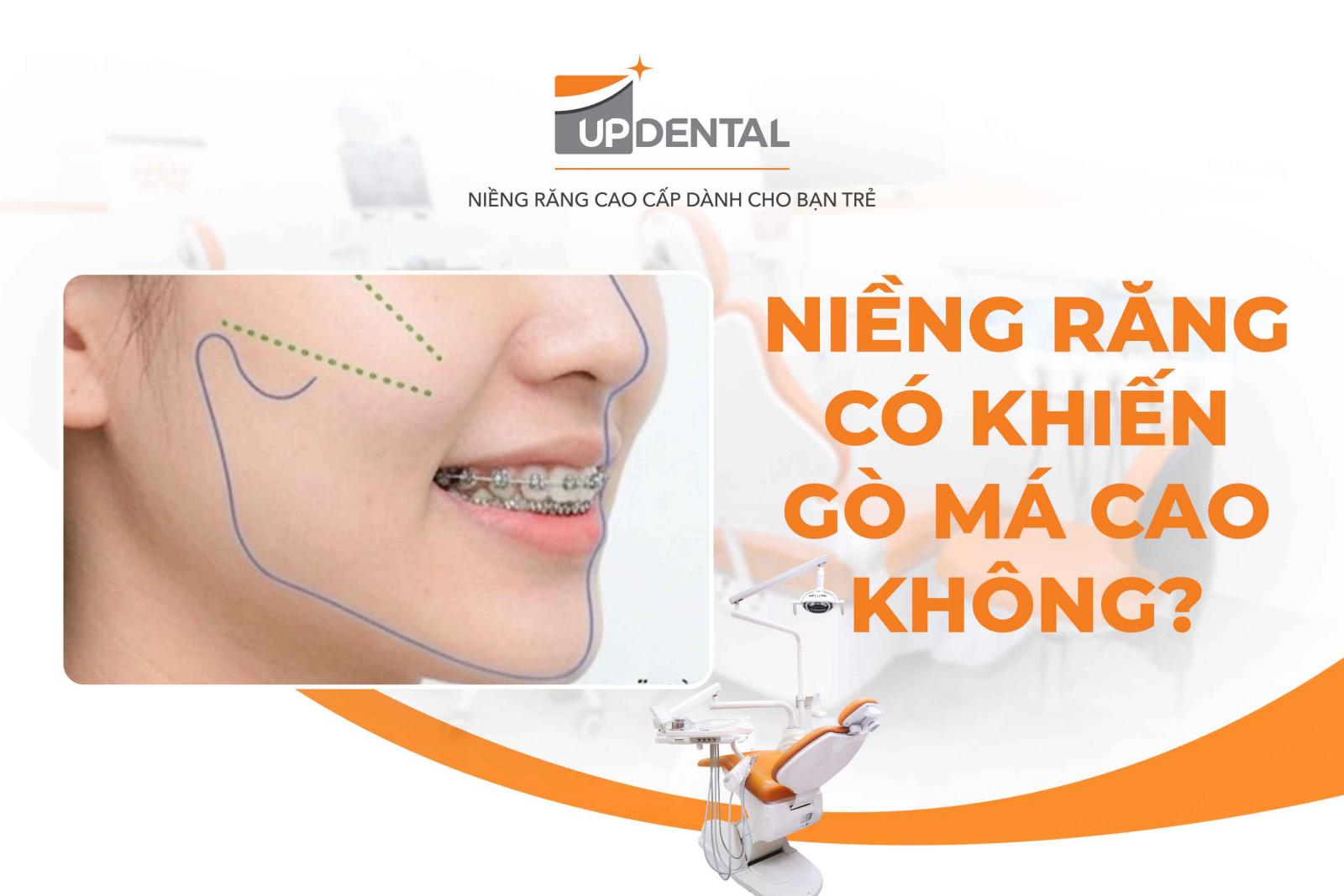 Niềng răng có khiến gò má cao không?