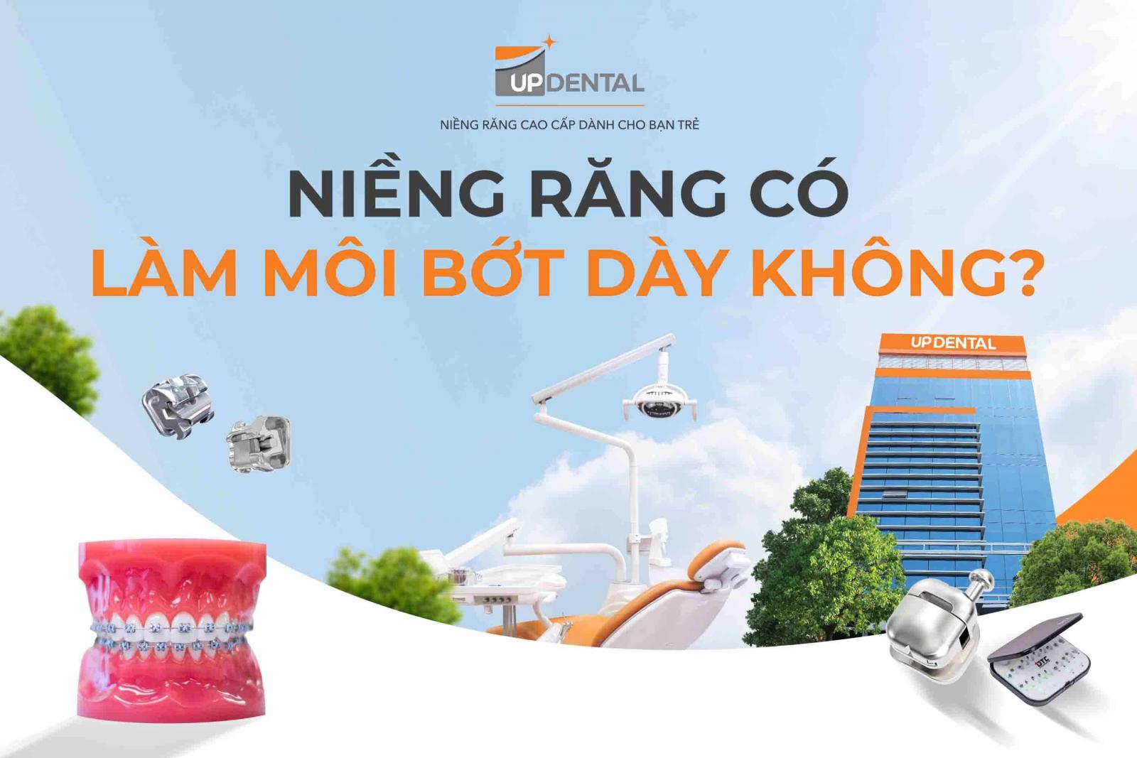 Niềng răng có làm môi bớt dày không?