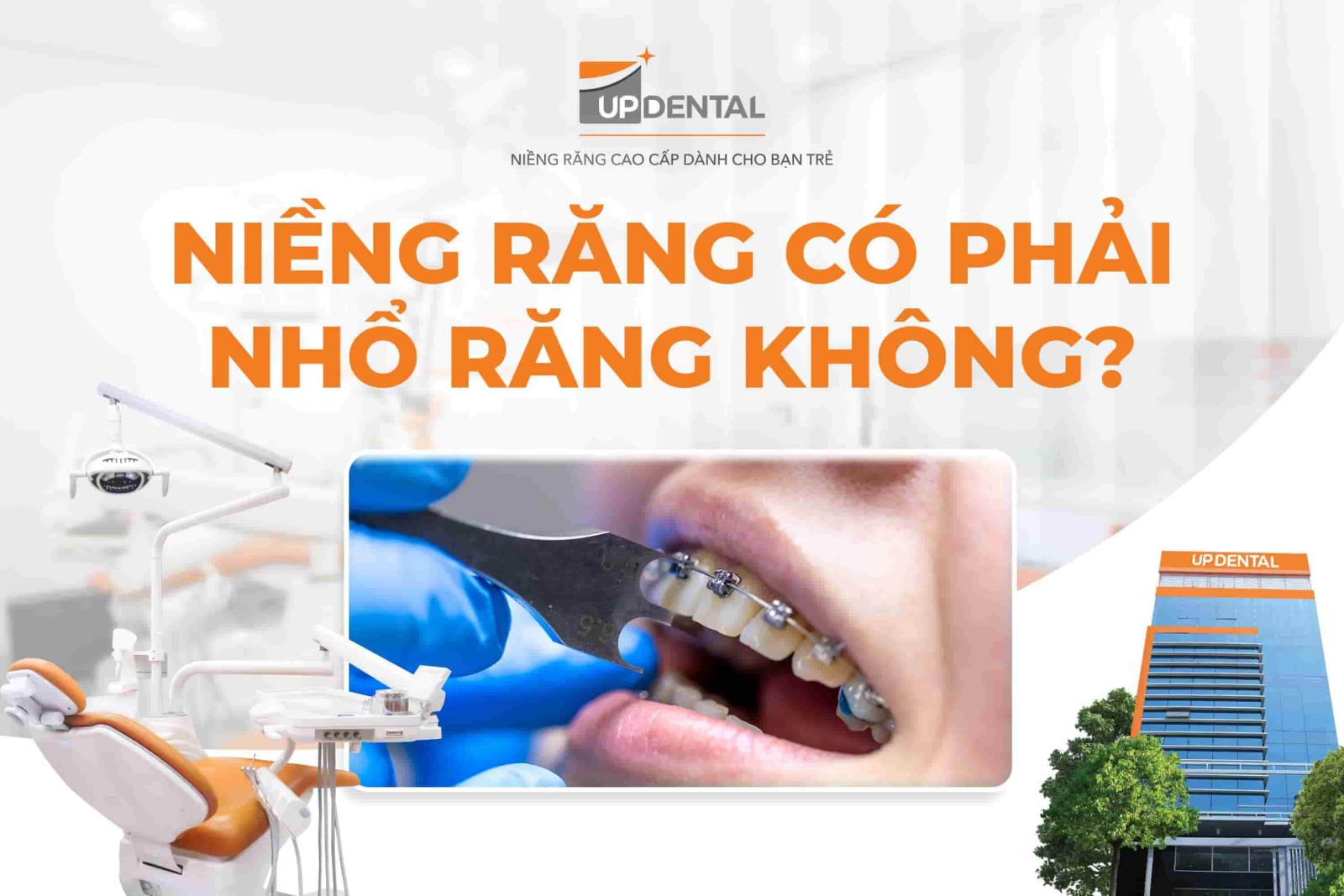 Niềng răng có phải nhổ răng không?