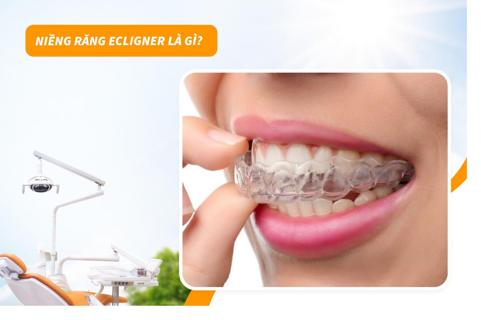Niềng răng Ecligner là gì?