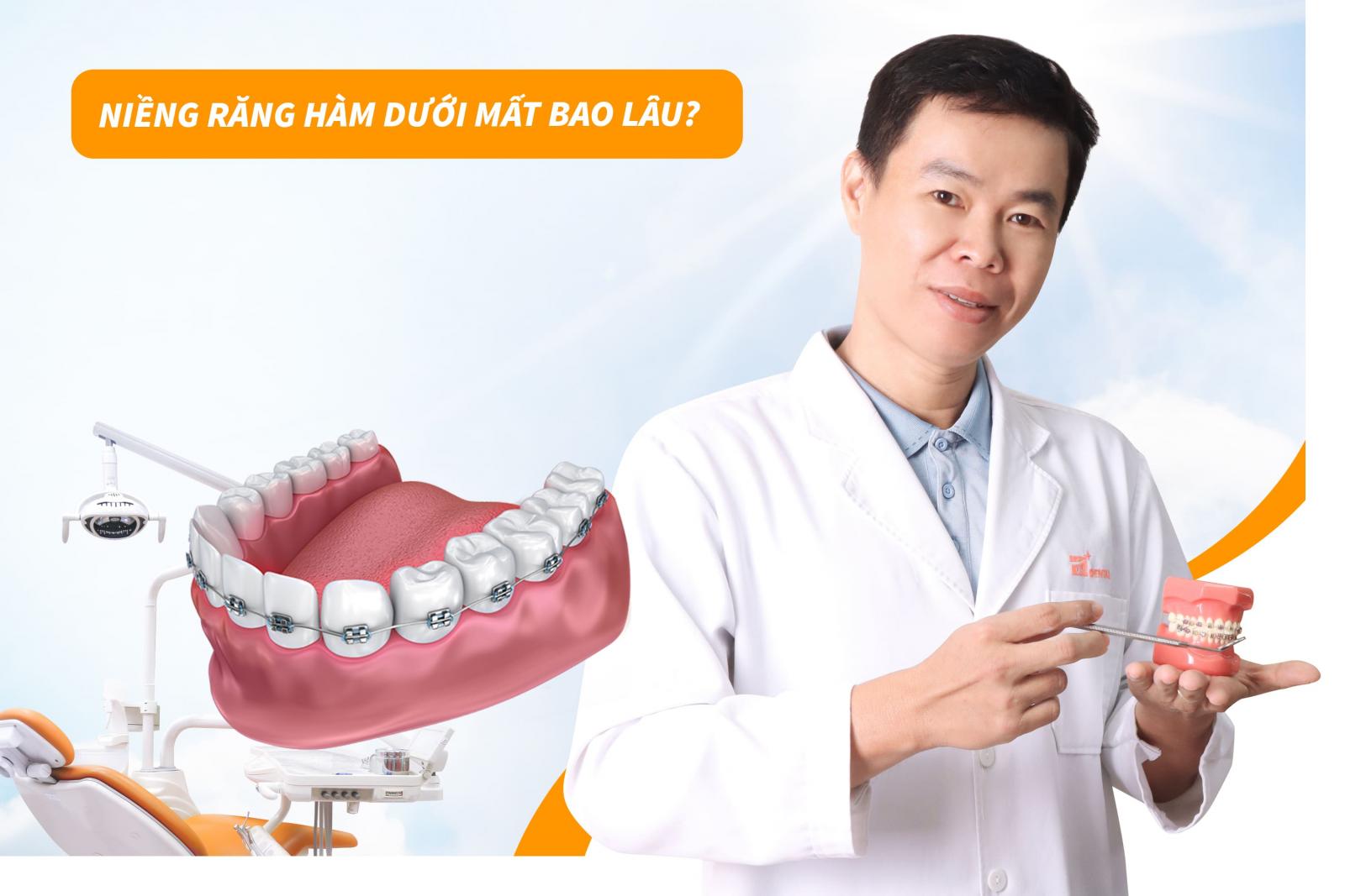 Niềng răng hàm dưới mất bao lâu?