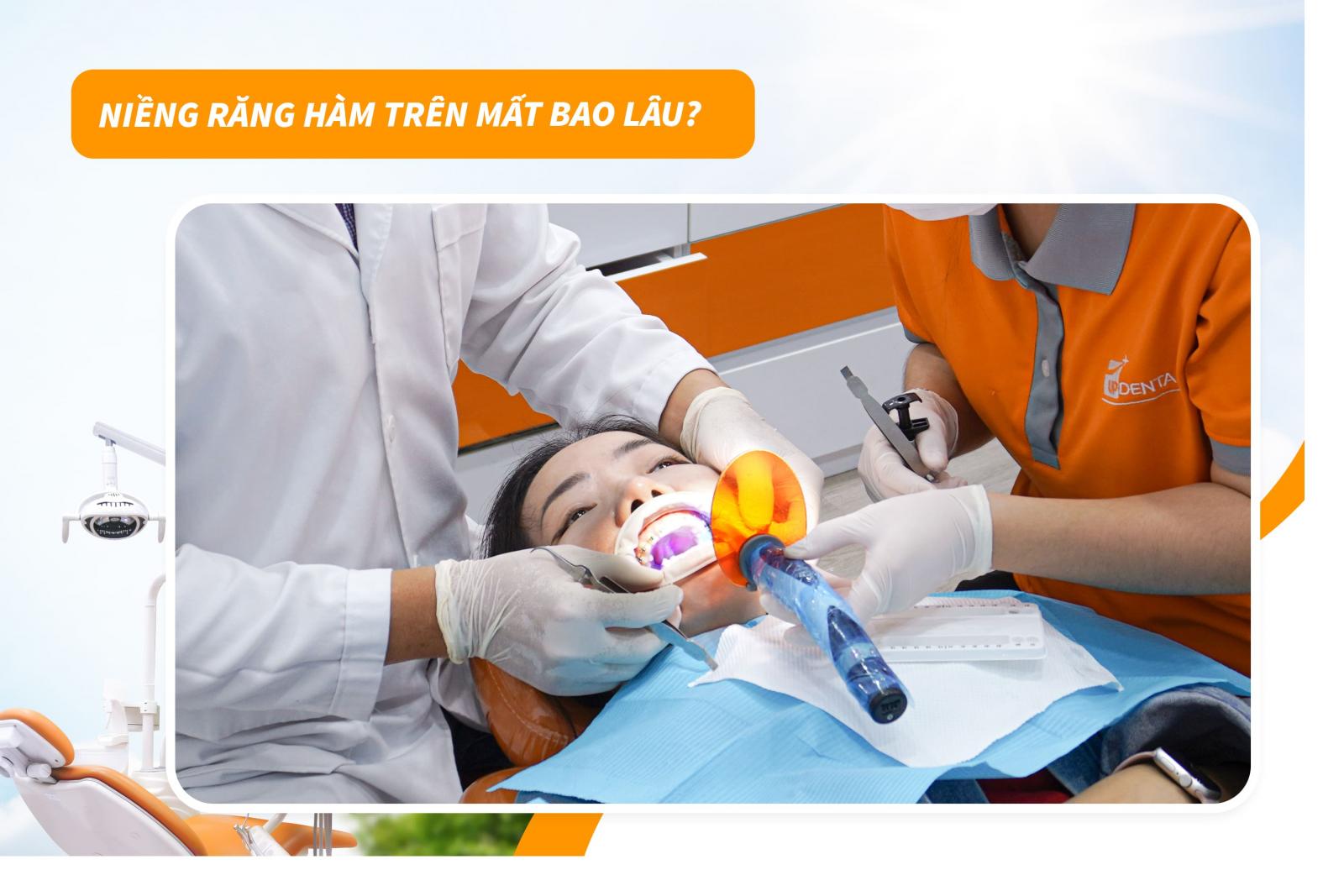 Niềng răng hàm trên mất bao lâu?