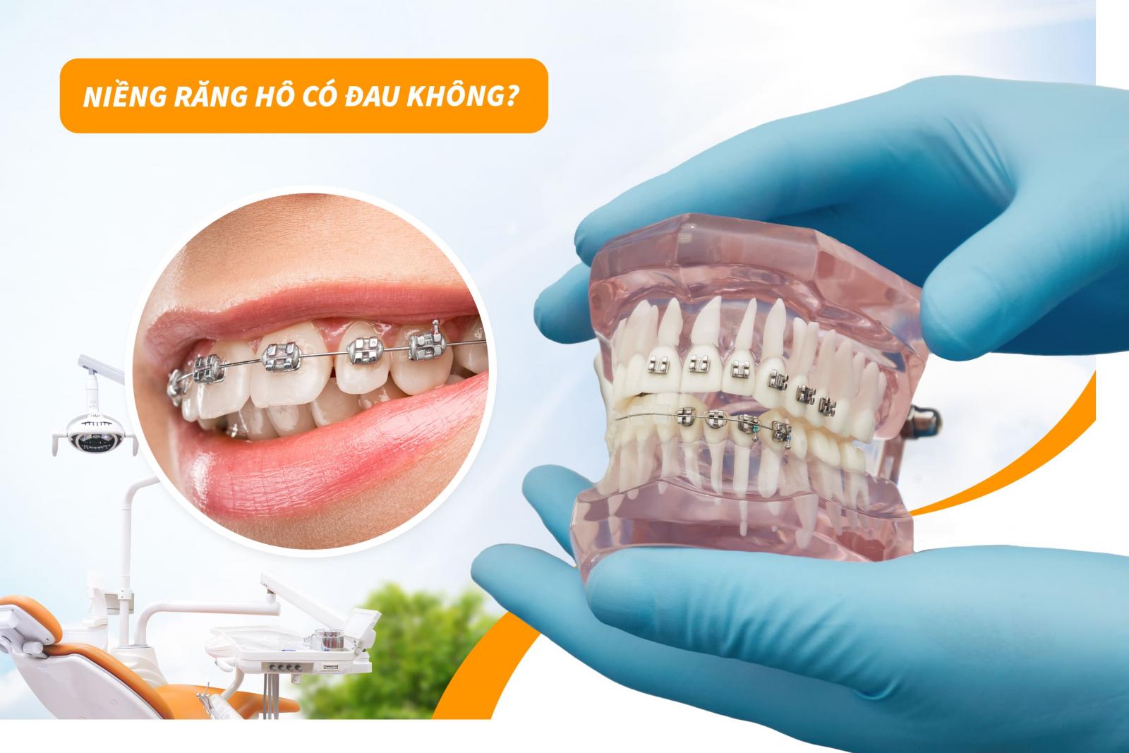 Niềng răng hô có đau không?