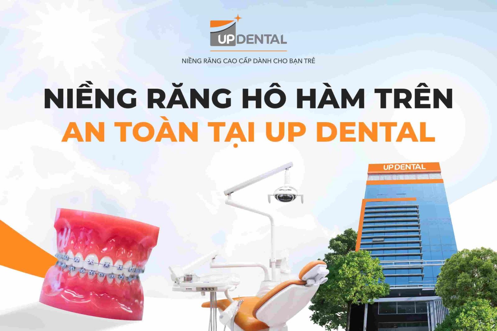 Niềng răng hô hàm trên an toàn tại Up Dental