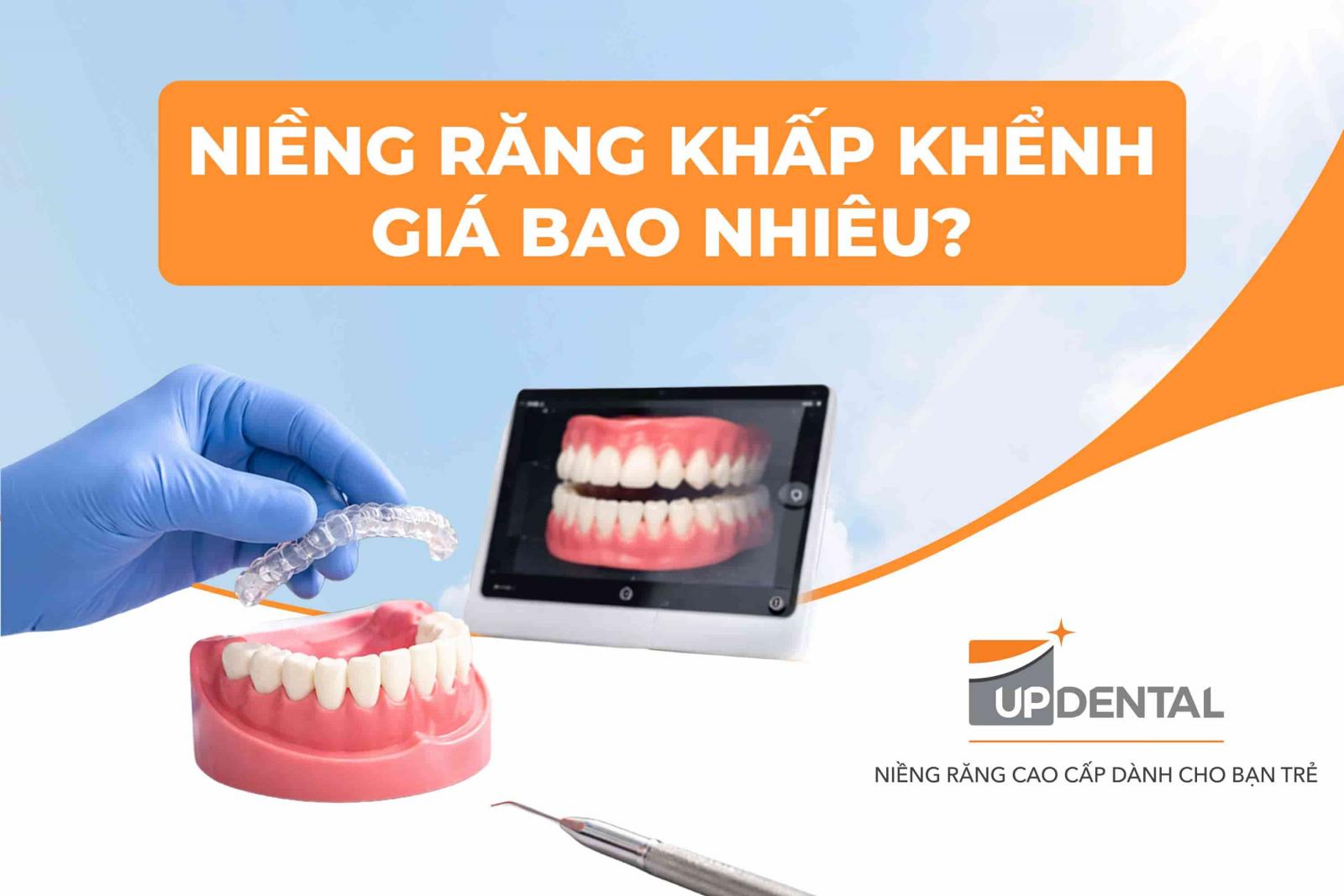 Niềng răng khấp khểnh giá bao nhiêu?