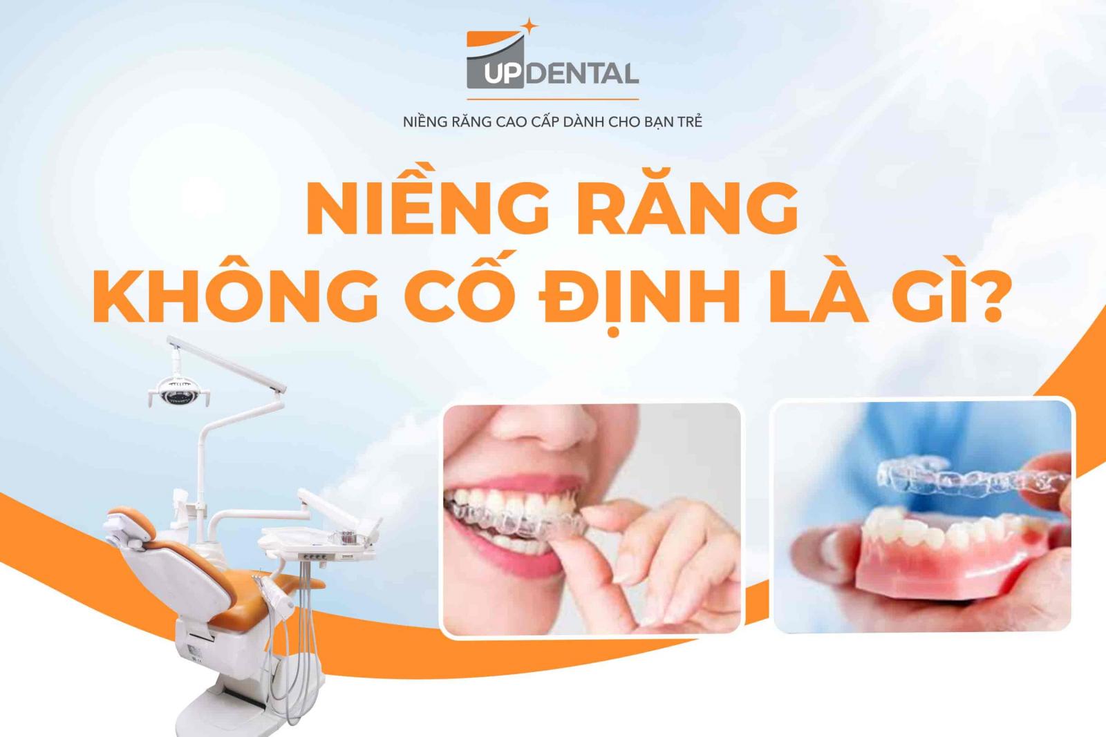 Niềng răng không cố định là gì?