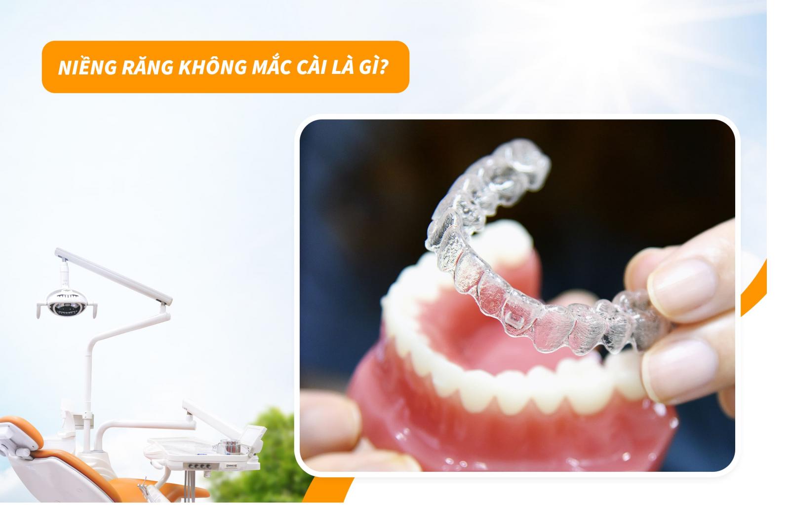 Niềng răng không mắc cài là gì?