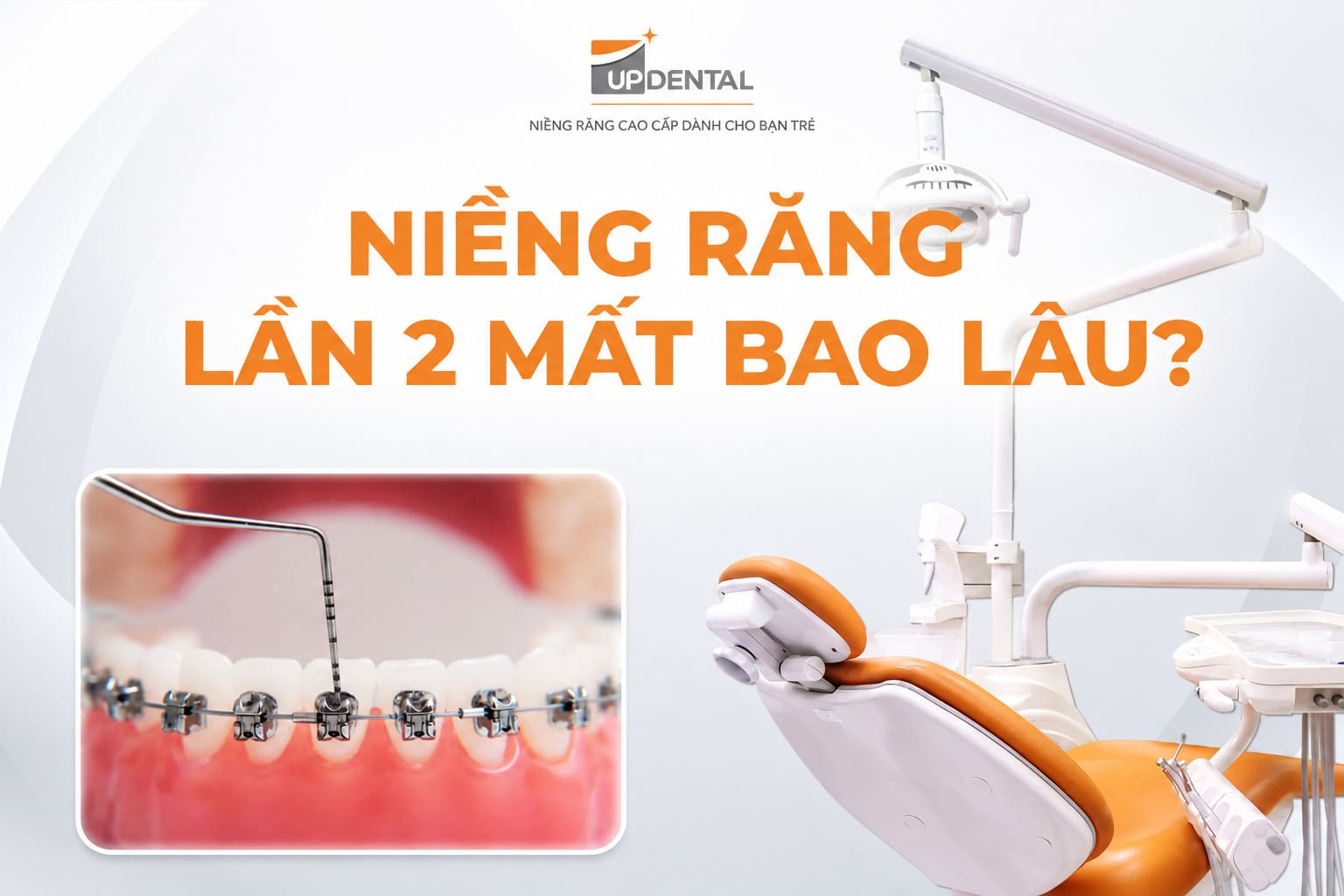 Niềng răng lần 2 mất bao lâu?