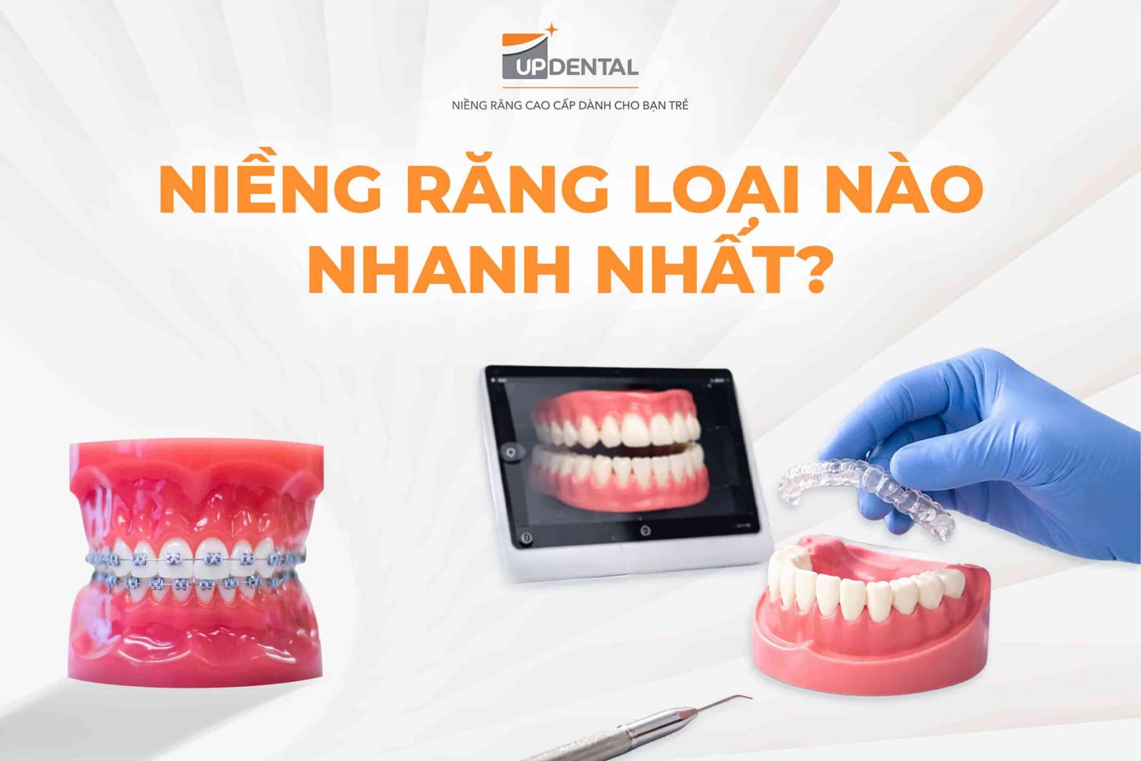 Niềng răng loại nào nhanh nhất?