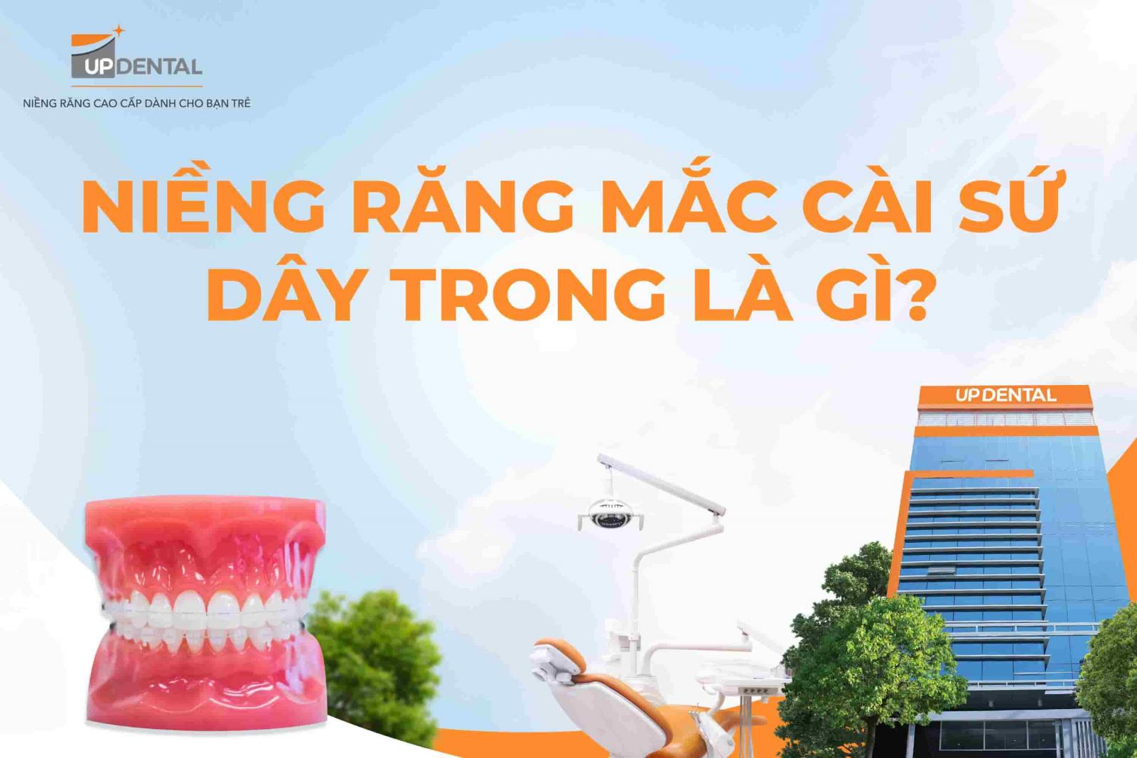 Niềng răng mắc cài sứ dây trong là gì?
