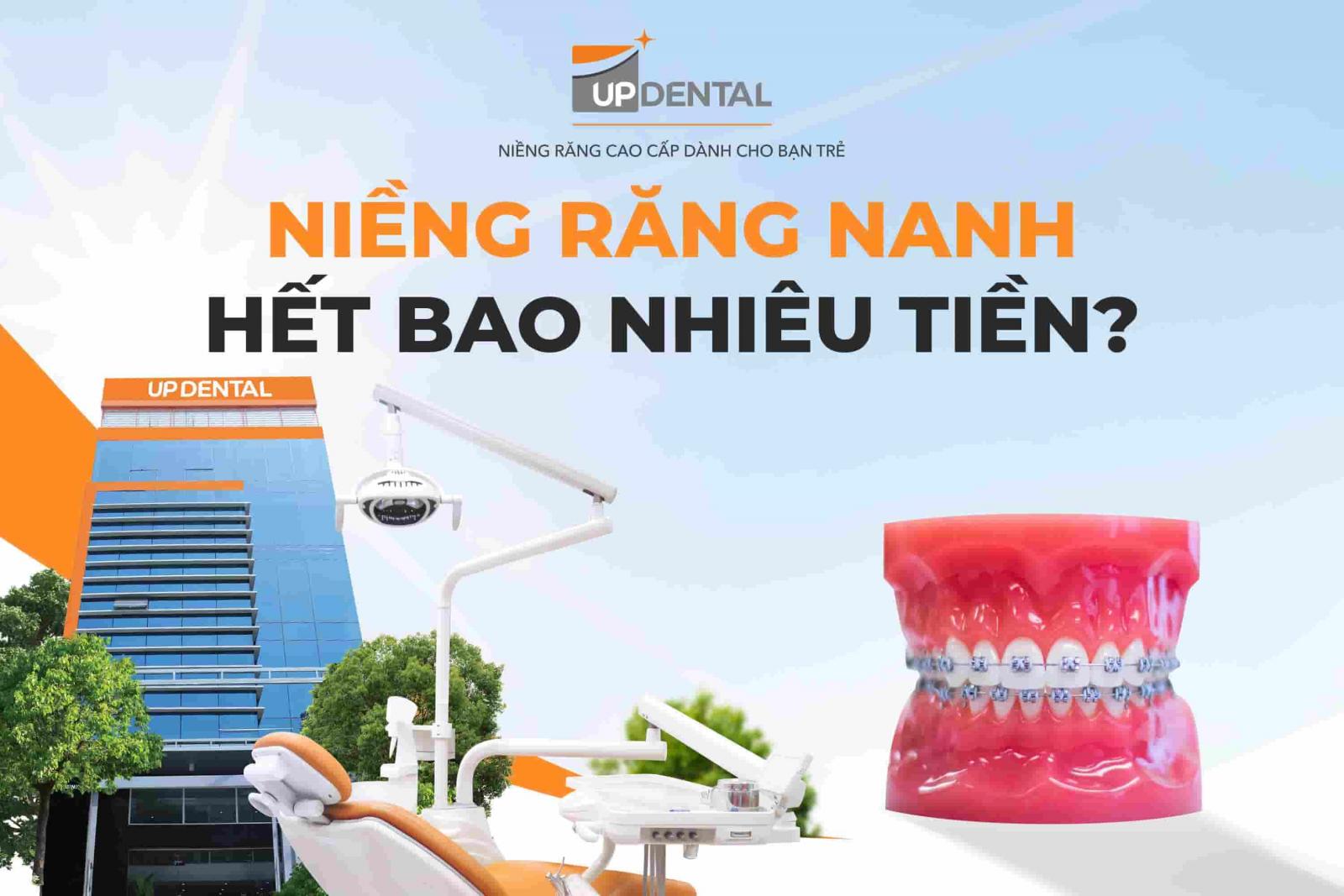 Niềng răng nanh hết bao nhiêu tiền?