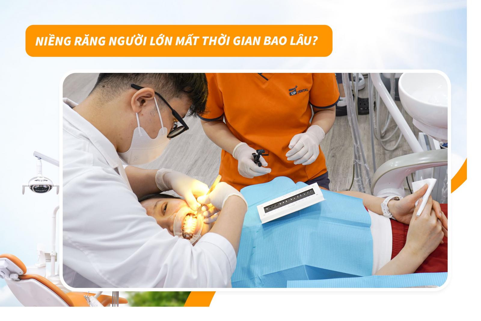 Niềng răng người lớn mất thời gian bao lâu?